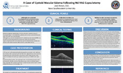 A Case of Cystoid Macular Edema Following Nd:YAG Capsulotomy 