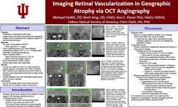 Imaging Retinal Vascularization in Geographic Atrophy via OCT Angiography