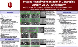 Michael DeWit, OD; Brett King, OD, FAAO; Ann E. Elsner, PhD, FAAO, FARVO, Fellow Optical Society of America; Chris Clark, OD, PhD Imaging Retinal Vascularization in Geographic Atrophy via OCT Angiography
