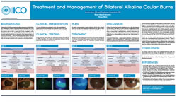 Treatment and Management of Bilateral Alkaline Ocular Burns