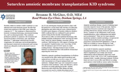 Sutureless amniotic membrane transplantation KID syndrome