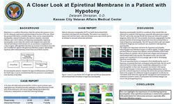 A Closer Look at Epiretinal Membrane in a Patient with Hypotony