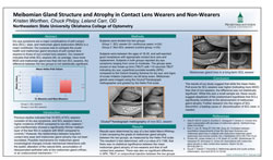 Kristen Worthen, Chuck Philpy, Leland Carr, OD Meibomian Gland Structure and Atrophy in Contact Lens Wearers and Non-Wearers