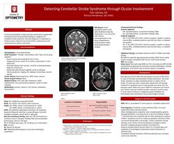 Detecting Cerebellar Stroke Syndrome Through Ocular Involvement
