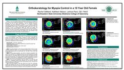 Orthokeratology for Myopia Control in a 10 Year Old Female