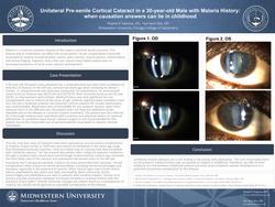 Unilateral Presenile Cortical Cataract in a 30-year-old Male with Malaria History: when causation answers can lie in childhood
