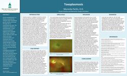 An Ocular Manifestation of Toxoplasmosis