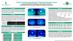A Case of Filamentary Keratitis Treated with Scleral Lenses