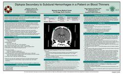 Diplopia Secondary to Subdural Hemorrhages in a Patient on Blood Thinners