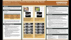 Foveoschisis Secondary To Posterior Staphyloma With High Myopia