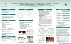 Low Vision Rehabilitation of Homonymous Hemianopsia Secondary to Trauma