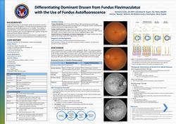 Differentiating between Dominant Drusen and Fundus Flavimaculatus with the use of Fundus Autofluorescence