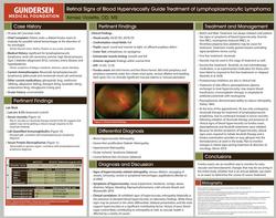 Retinal Signs of Blood Hyperviscosity Guide Treatment of Lymphoplasmacytic Lymphoma