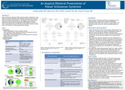 An Atypical Bilateral Presentation of Posner-Schlossman Syndrome