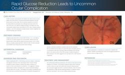 Rapid Glucose Reduction Leads to Uncommon Ocular Complication