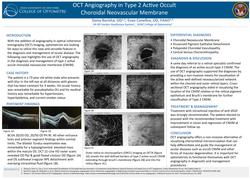 OCT Angiography in Type 2 Active Occult Choroidal Neovascular Membrane