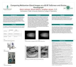 Comparing Meibomian Gland Images on xiQ IR TelScreen and Oculus Keratograph