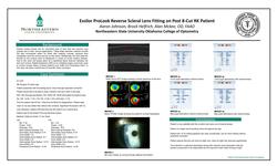 Essilor ProLook Reverse Scleral Lens Fitting on Post 8-Cut RK Patient