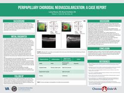 Peripapillary Choroidal Neovascularization: A Case report