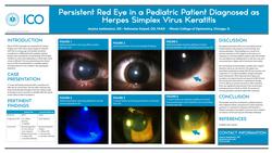 Persistent Red Eye in a Pediatric Patient Diagnosed as Herpes Simplex Virus Keratitis