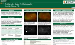 Proliferative Sickle Cell Retinopathy
