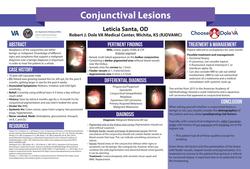 Conjunctival Lesions