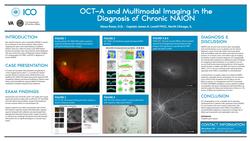 OCT-A and Multimodal Imaging in Diagnosis of Chronic NAION