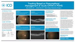 Treating Based On Presumptions: Management of Acute CNVM in POHS