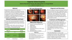 Superior Scleral Surprise: Anterior Necrotizing Scleritis with Inflammation in a Young Patient