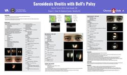 Sarcoid Uveitis With Bell's Palsy