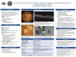 Systemic Considerations for an Atypical Presentation of Severe Unilateral Retinal Ischemia
