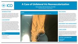 A Case of Iris Neovascularization
