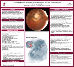 A new look on life: effective co-management of morning glory syndrome