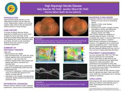 Vogt-Koyanagi-Harada Disease