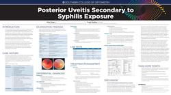 Posterior Uveitis Secondary to Syphilis Exposure