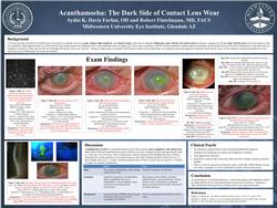 Acanthamoeba: The Dark Side of Contact Lens Wear