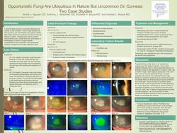 Opportunistic fungi are ubiquitous in nature but uncommon on corneas: two case studies