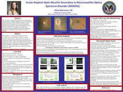 Acute Atypical Optic Neuritis Secondary to Neuromyelitis Optica Spectrum Disorder (NMOSD)