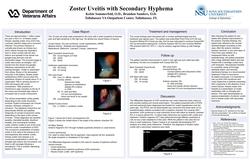 Zoster Uveitis with Secondary Hyphema