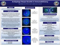 Archipelago Keratitis