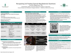 Recognizing and Treating Capsular Bag Distension Syndrome