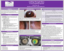 Looking Through Glass: a Look at Epithelial Ingrowth