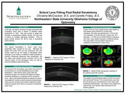 Scleral Lens Fitting Post RK