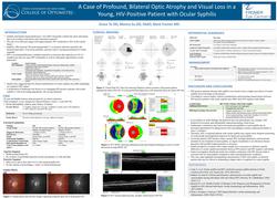 A Case of Profound, Bilateral Optic Atrophy and Visual Loss in a Young, HIV-Positive Patient with Ocular Syphilis