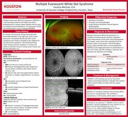 Multiple Evanescent White Dot Syndrome
