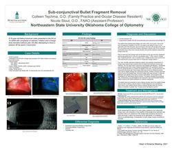 Sub-conjunctival Bullet Fragment Removal