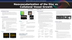 Neovascularization of the Disc vs. Collateral Vessel Growth