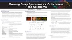 Morning Glory Syndrome vs. Optic Nerve Coloboma