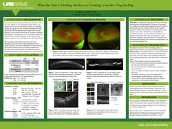 When the Pain is Peaking and the Eye Isn't Leaking, Consider Drug Seeking