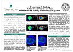 Orthokeratology: A Case Study